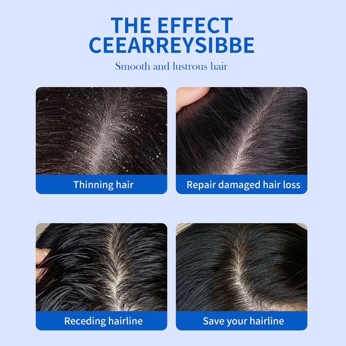 325ml Selenium Disulfide Anti  - Hair Care Dandruff review and price
